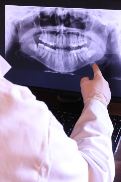 Best Emergency Dental Care for Broken or Chipped Teeth in Cottonwood, CA